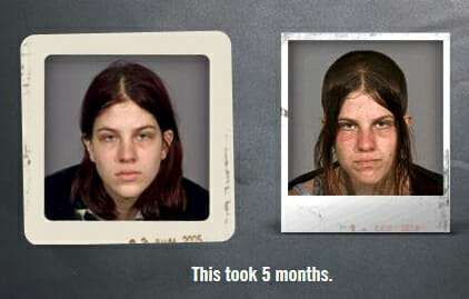 meth mugshots
